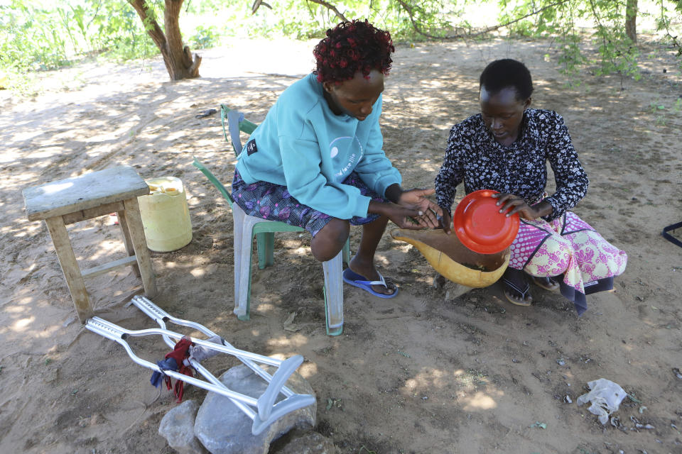 Esther Kangali, who lost her right leg to a snake bite, sits with her mother outside her home in Kitui, Kenya, Monday, May 13, 2024. Overall in Kenya, about 4,000 snakebite victims die every year while 7,000 others experience paralysis or other health complications, according to the local Institute of Primate Research. (AP Photo/Andrew Kasuku)