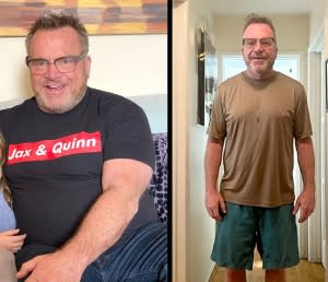 Tom Arnold Shows Off Dramatic 75-Lb Weight Loss After Suffering Mini-Stroke