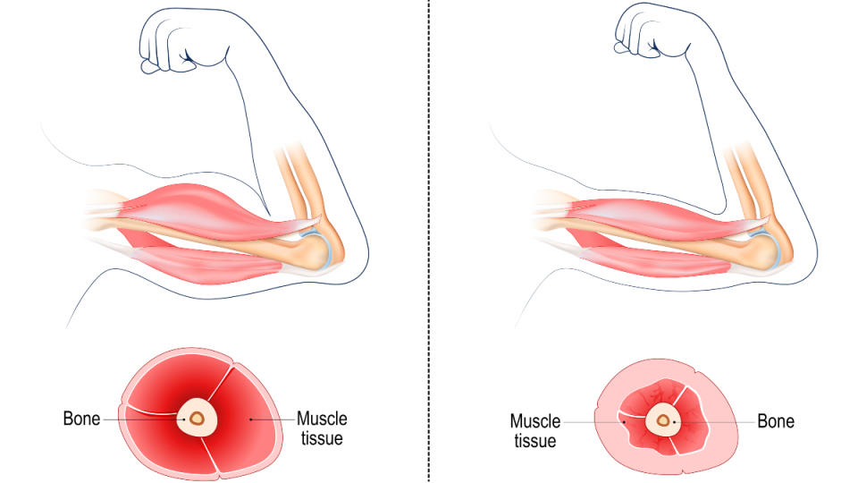 Mavens Disclose the Easiest Diet to Stay Muscle tissues Robust as You Age + Tips on how to Get Extra