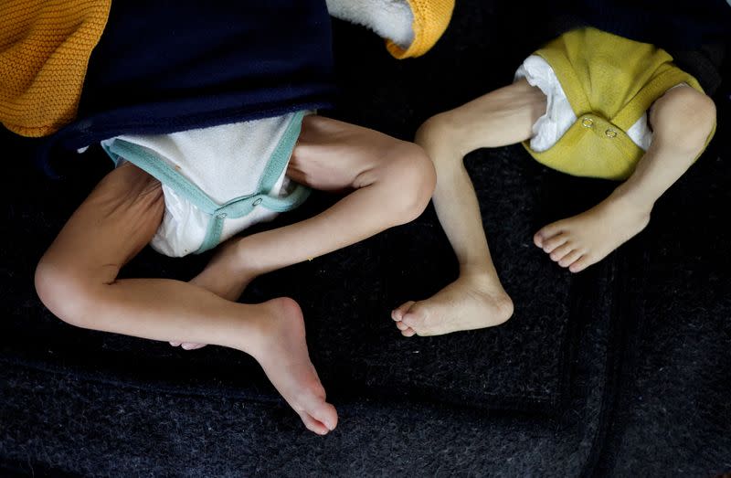 FILE PHOTO: Palestinian children suffering from malnutrition receive treatment at a healthcare center, amid widespread hunger, as the conflict between Israel and Hamas continues, in Rafah, in the southern Gaza Strip