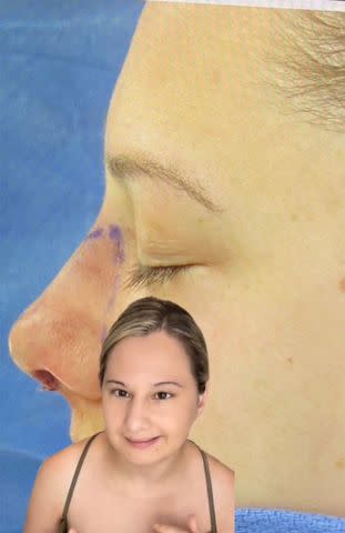 <p>Gypsy-Rose Blanchard/Tiktok</p> Gypsy-Rose Blanchard's nose job after surgery