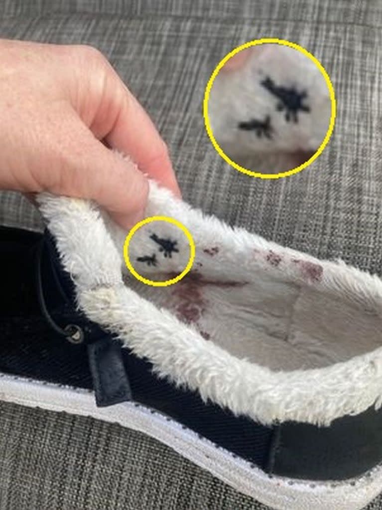A Florida mom claims blood came “pouring” out of her foot after being pierced by a razor-sharp stud allegedly lodged inside a $12 pair of boots purchased via Temu. Kennedy News & Media