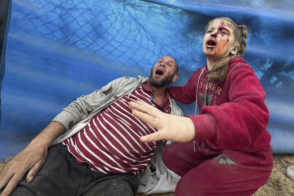 Wounded Palestinians react after an Israeli strike on Al Zawayda, central Gaza Strip, Thursday, Dec. 28, 2023. (AP Photo/Mohammed Asad)