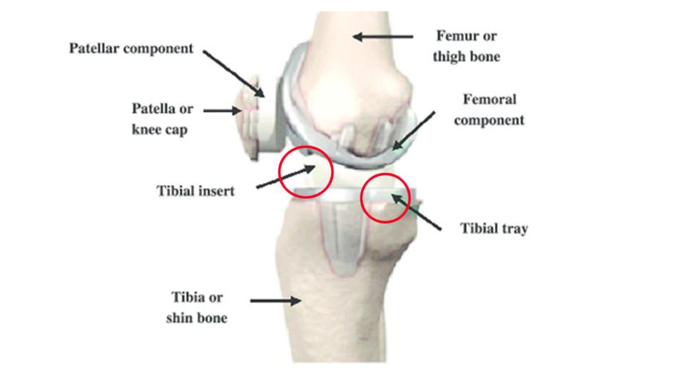 One of the packaging layers for the tibial insert was proven faulty and may allow oxygen from the air to diffuse into this tibial insert, leading to oxidation. Source: Hospital for Special Surgery (HSS)