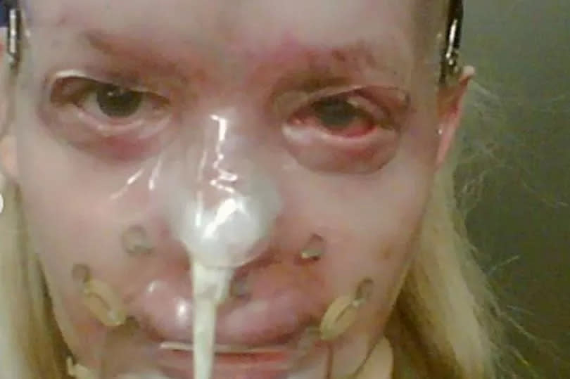 Katie has shared pictures from the aftermath of the acid attack
