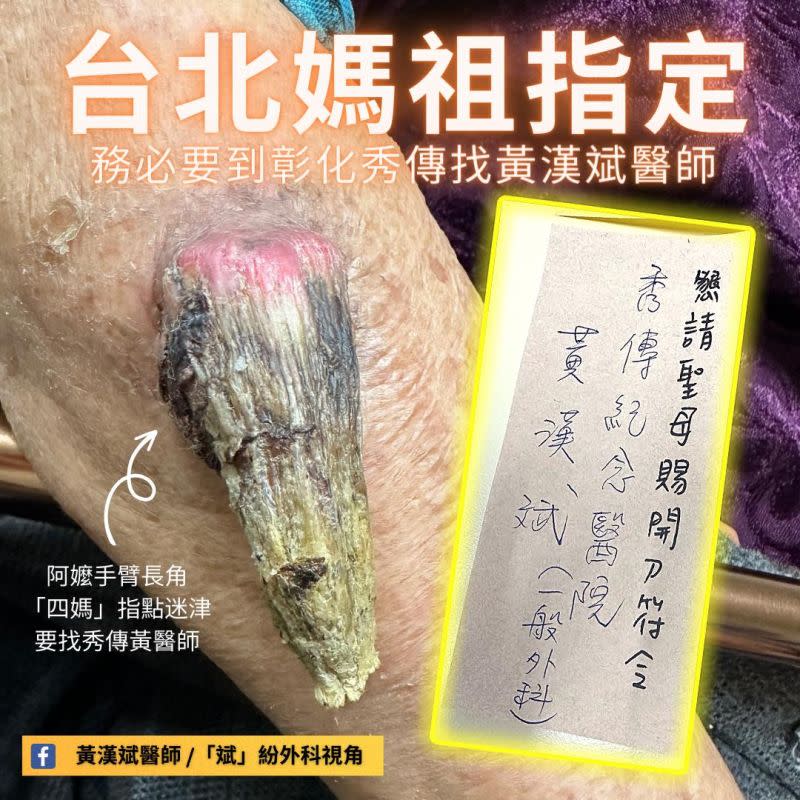 ▲一名91歲的阿嬤拿著神明指示的「轉診單」來找黃醫師看診，令人感到神奇。（圖/黃漢斌醫師臉書）