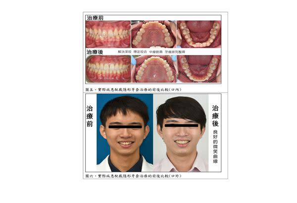 （圖片提供／臺北榮總醫院）