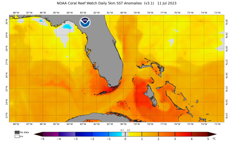 NOAA projections show how much higher sea surface temperatures off Florida currently are, with some reaching 3 degrees Celsius, or about 5.5 degrees Fahrenheit.