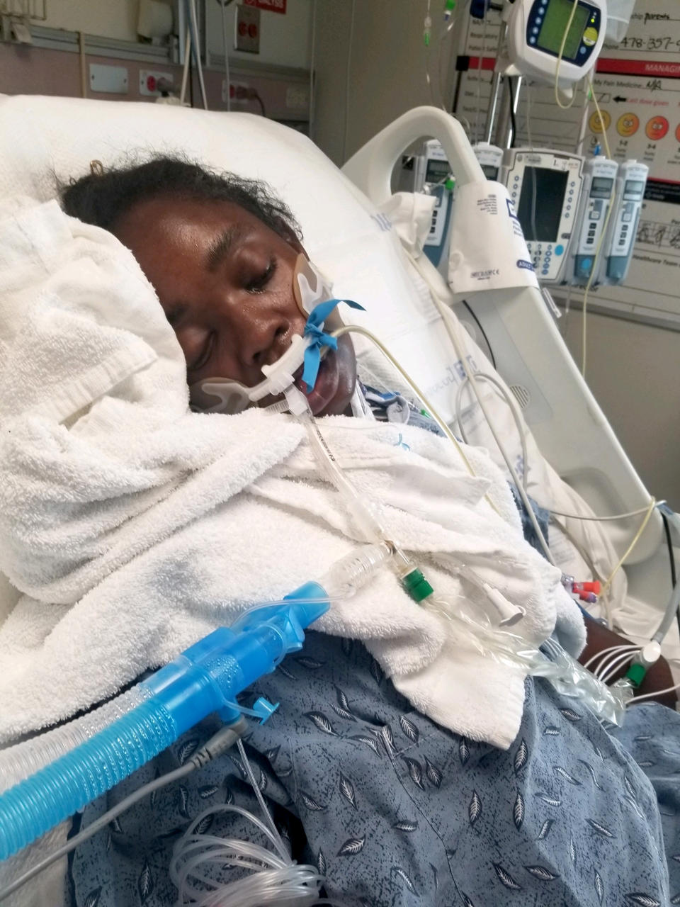 Brianna Grier, 28, at Grady Memorial Hospital in Atlanta after she was placed on a ventilator. (Courtesy Lottie Grier)