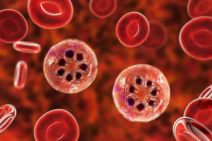 The malaria-infected red blood cell. 3D illustration showing parasite Plasmodium malariae in the schizont stage