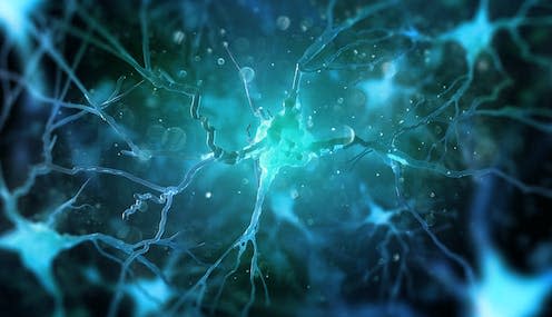   <span class="attribution"><a class="link " href="https://www.shutterstock.com/image-illustration/neurons-brain-on-dark-background-3d-700768720" rel="nofollow noopener" target="_blank" data-ylk="slk:Andrii Vodolazhskyi/Shutterstock;elm:context_link;itc:0;sec:content-canvas">Andrii Vodolazhskyi/Shutterstock</a></span>