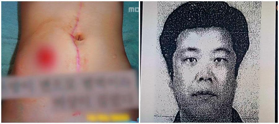 綁架、性侵凌虐8歲女童的趙斗淳（右圖），做案手法殘忍無人性，案件被改編成《希望：為愛重生》。（翻攝自Naver）