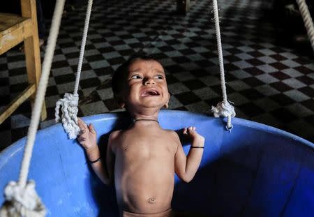 Sufated, a 10-month-old malnourished Rohingya boy, cries while being weighed at the Action Against Hunger center in Kutupalong refugee camp near Cox's Bazar, Bangladesh October 22, 2017. REUTERS/Zohra Bensemra