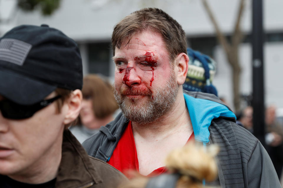 Pro-Trump rally turns violent in Berkeley