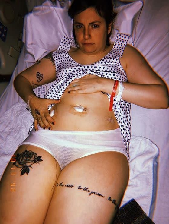 Lena Dunham revealed that she had her left ovary removed on Oct. 17, 2018. The actress, who shared a picture of herself following the surgery, said the ovary "got worse and worse" from her full hysterectomy in February. In the lengthy Instagram post, she got candid about health care and the need for women to "work extra hard just to prove what we already know about our own bodies and beg for what we need to be well. It’s humiliating."
