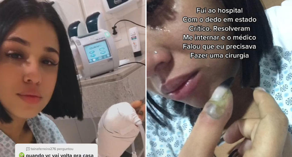 Two stills from Jenneffer Souza's TikTok showing her thumb infection.