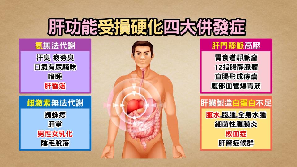 ▲當肝臟機能受損時，會有四大併發症產生。