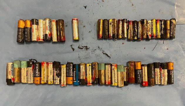 The recovered batteries included both AA and AAA varieties. (Photo: Irish Medical Journal)