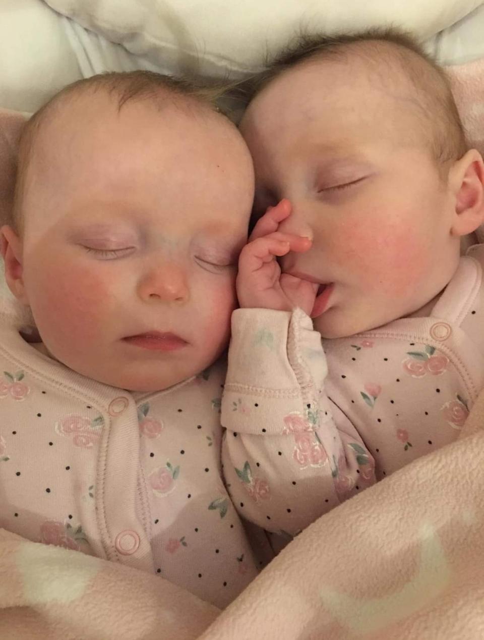 Holly and Darcy were conceived one month apart. (Kennedy News and Media)