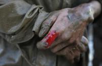 Blood congeals on a student's finger during training at Tianjiao Special Guard/Security Consultant camp on the outskirts of Beijing December 1, 2013. Former Chinese soldier Chen Yongqing has big ambitions for his bodyguard training school Tianjiao, which he says is China's first professional academy to train former soldiers and others as personal security guards. Chen charges 500,000 yuan ($82,400) a year for each protector as China's rich and famous look to bolster their safety and sense of importance. Picture taken December 1, 2013. REUTERS/Jason Lee (CHINA - Tags: BUSINESS SOCIETY) ATTENTION EDITORS: PICTURE 17 OF 26 FOR PACKAGE 'CHINA'S BODYGUARD SCHOOL' TO FIND ALL IMAGES SEARCH 'TIANJIAO'