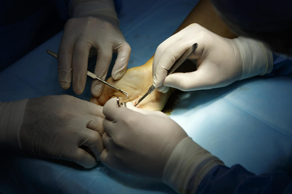 Close-up of surgeons' gloved hands performing surgery on a patient's foot. Surgical instruments and a blue drape are visible