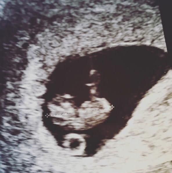 The couple announced Rachael was 12 weeks along last week. Source: Instagram