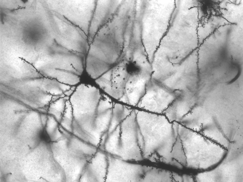 human neuron