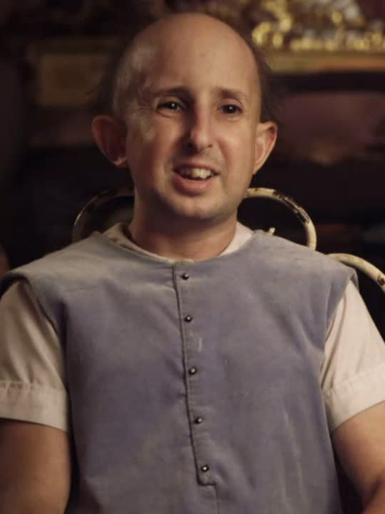 Ben Woolf, who played circus freak Meep on “American Horror Story: Freak Show,” died February 23 from a stroke after being struck by a SUV in Hollywood. Prior to “Freak Show,” the 4-foot-4 Woolf played the demon baby Infantata in “American Horror Story’s” first season, “Murder House.” He was just 34 years old. (Source: Yahoo Magazines PYC)