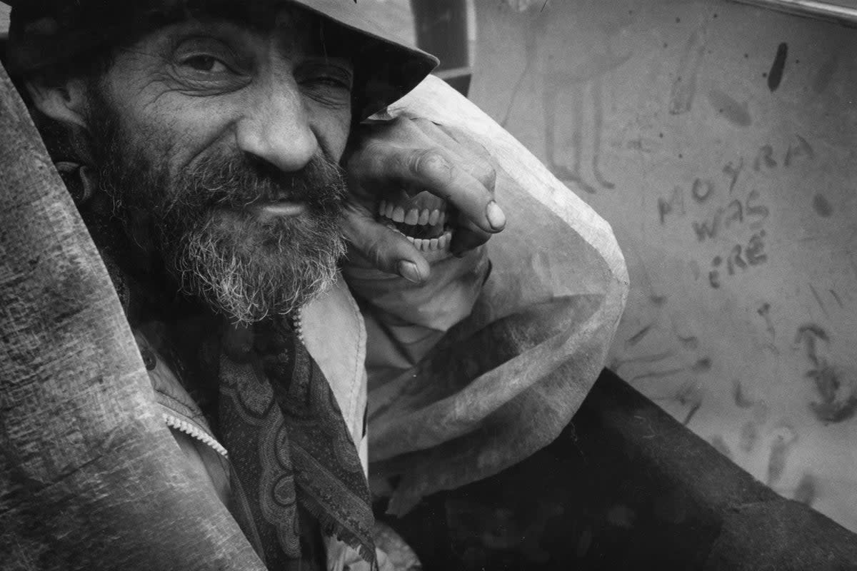 Homeless man Zy with his new set of false teeth (Photos by Moyra Peralta/Courtesy of Bishopsgate Institute)