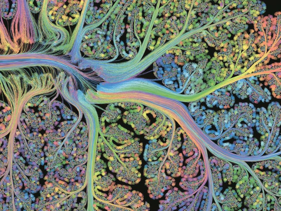 Kunst und Wissenschaft: So haben Sie das Gehirn noch nie gesehen!