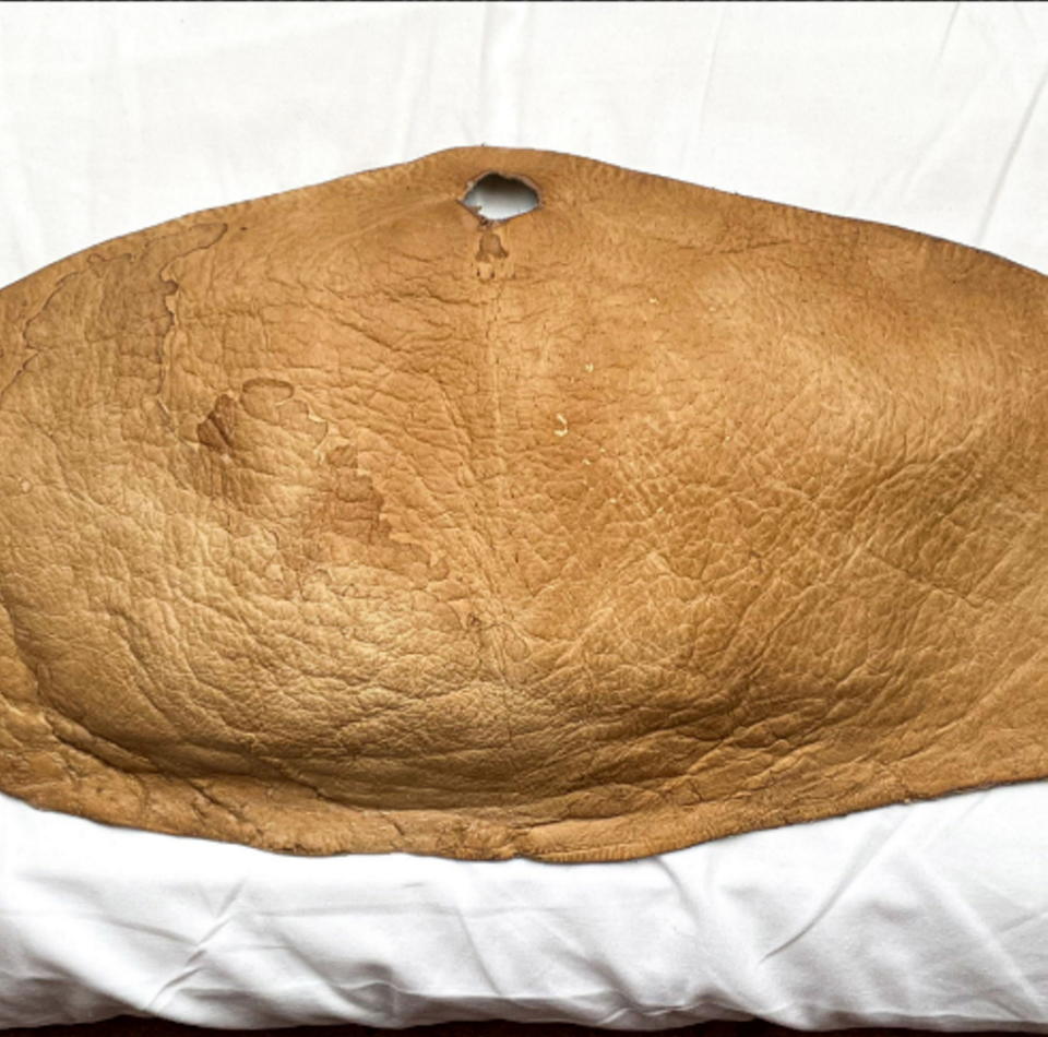 Skin from Katie Taylor's abdomen, after being turned to leather. (SWNS)