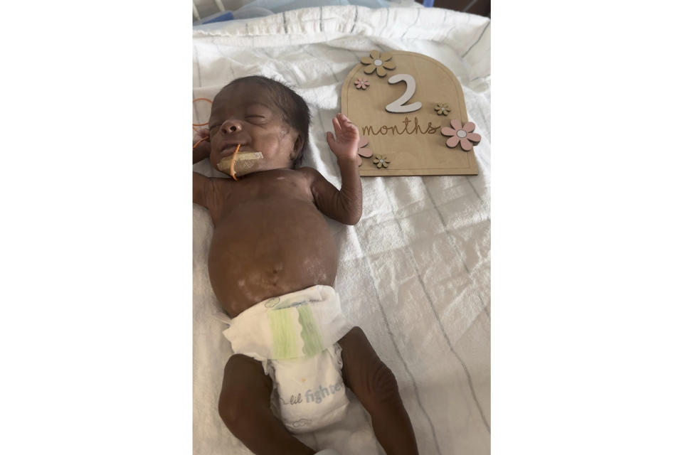 This undated photo shows 6-month-old Nyla Brooke Haywood, a baby girl born Nov. 17, 2023, at Silver Cross Hospital in New Lenox, Illinois. Nyla was born at just 22 weeks weighing 1 pound and 1 ounce, making her what’s known as a “micropreemie.” She left Silver Cross Hospital on Monday weighing a healthy 10 pounds, and was taken home by her first-time parents, NaKeya and Cory Haywood of Joliet, Illinois. (NaKeya Haywood via AP)