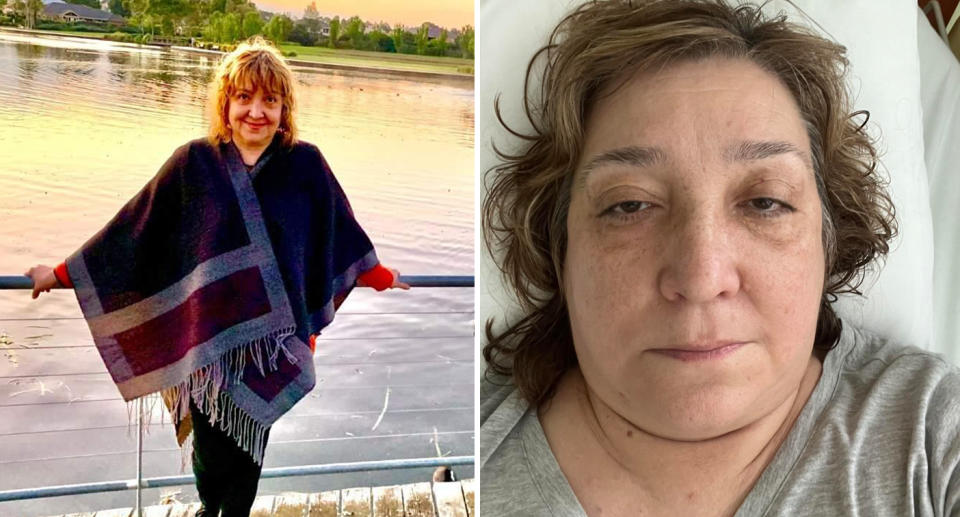 A photo of Ingrid Zubaydullaeva, who lives in Officer, Melbourne. A photo of Ingrid after she suffered a stroke in Ubud, Bali while at a wellness retreat.