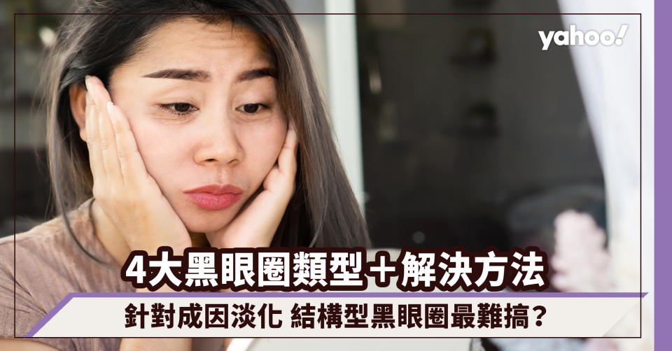 黑眼圈｜4大黑眼圈類型＋解決方法！針對成因輕鬆淡化 結構型黑眼圈最難搞？