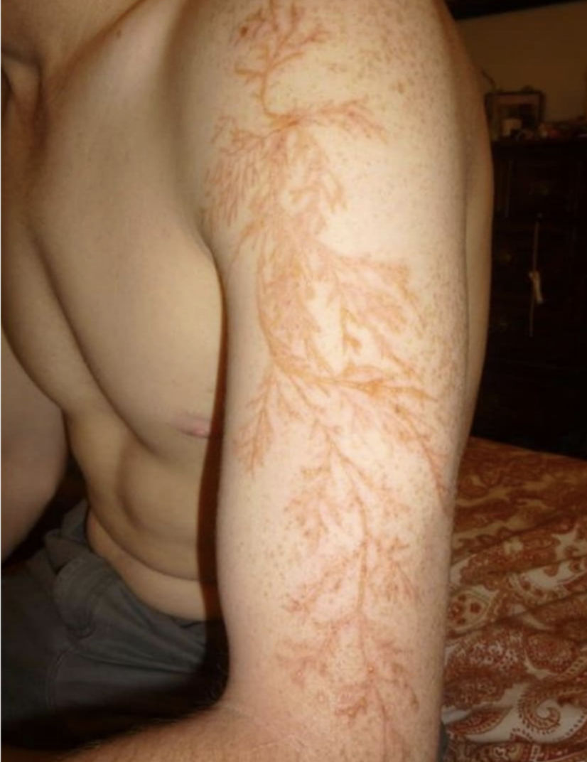 person's arm looks like it's tattooed with vines going down