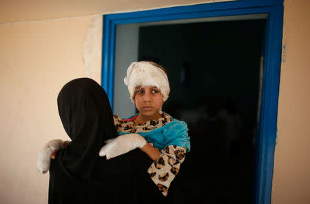 Wounded Iraqi girl Dua Nawaf, 8, whose family was killed in an airstrike in Mosul, is carried by her aunt at a hospital run by Medecins Sans Frontieres in Qayyara, Iraq April 6, 2017. REUTERS/Suhaib Salem