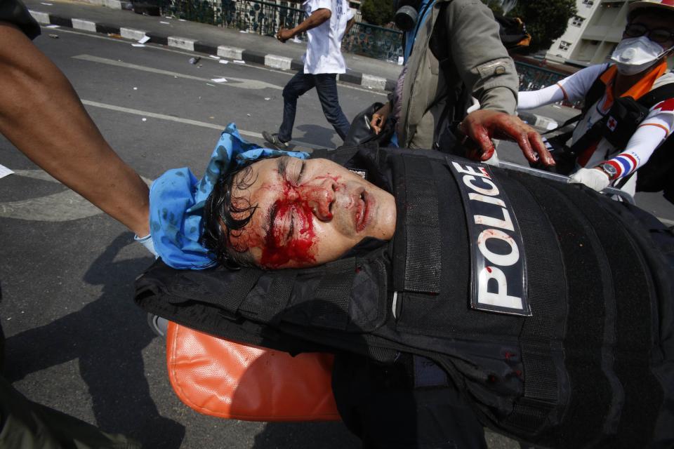 An injured Thai policeman is wheeled away from the scene of an explosion during clashes with anti-government protesters near Government House in Bangkok