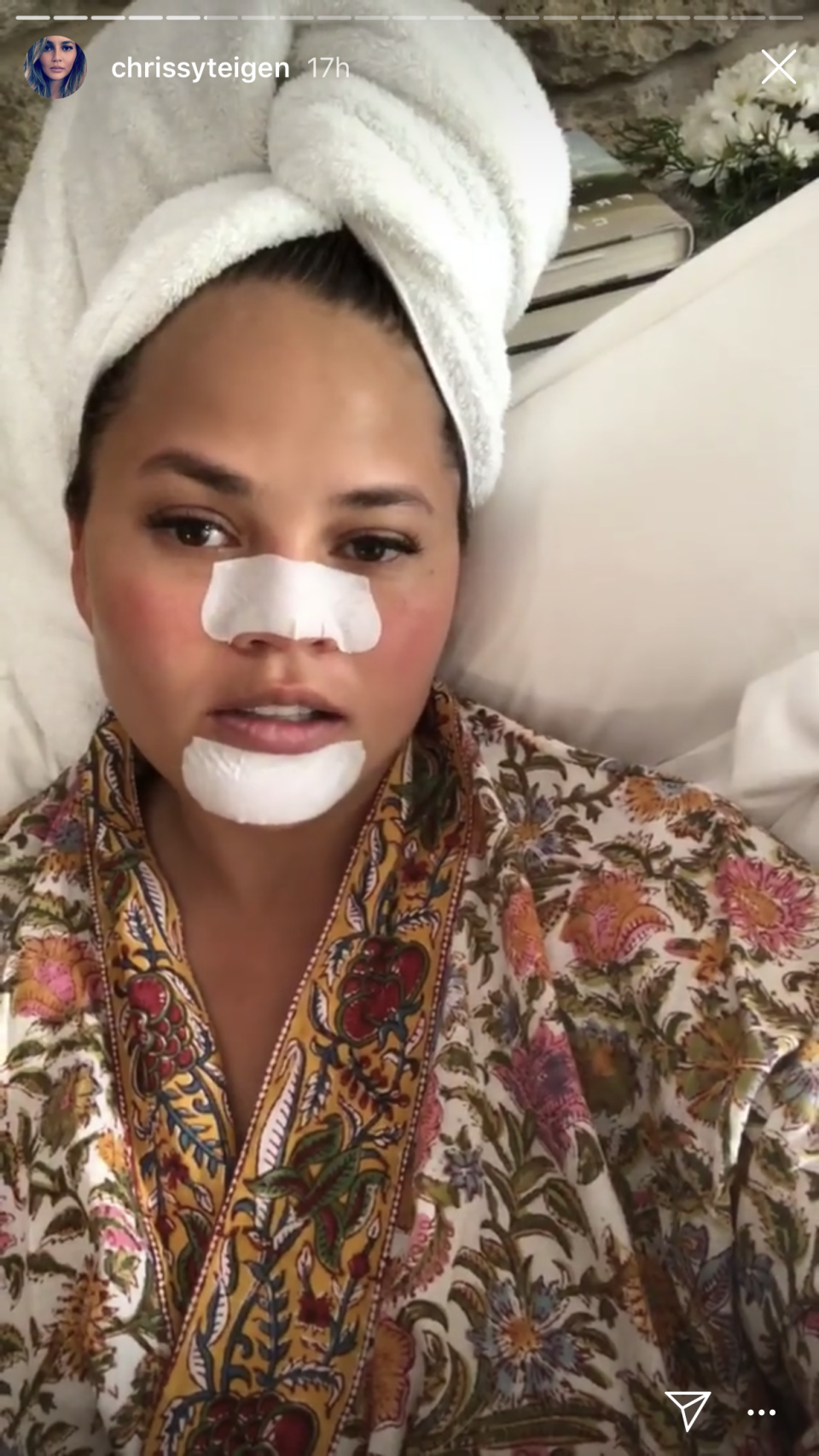 Chrissy Teigen relaxes in a bathrobe and towel turban while using Bioré Nose and Chin Strips. 