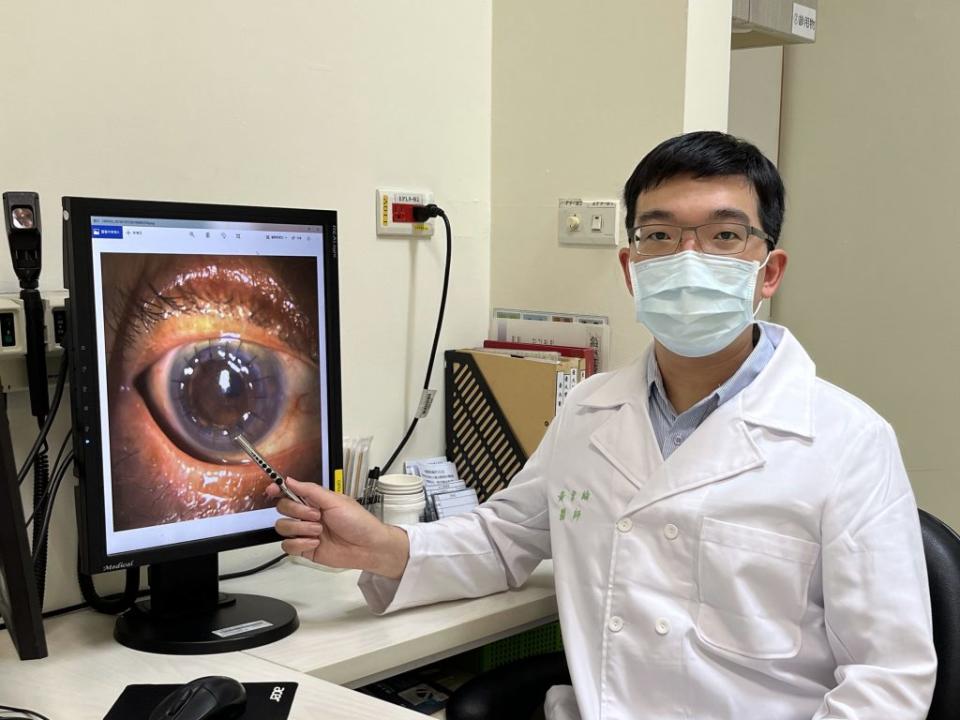 醫師黃韋綸說明，病人角膜經移植術後，恢復清澈透明。（圖／台大新竹分院提供）