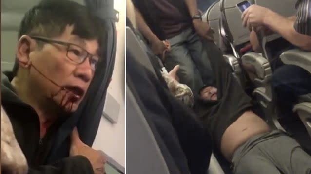 David Dao was dragged from a United flight last month and allegedly left bloodied in the process, sparking a series of viral complaints about airline behaviour. Source: Twitter
