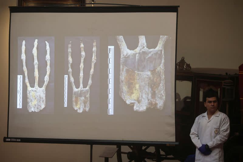 X-rays of studies carried out by the Institute of Legal Medicine of Peru on the 'alien mummies' are shown, in Lima