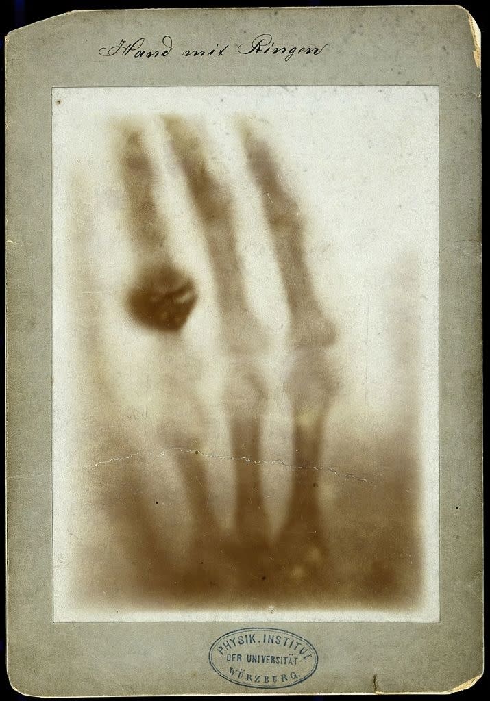 An early X-ray image shows a hand wearing a ring, labeled "Hand mit Ringen," produced by the Physik Institut der Universität Würzburg