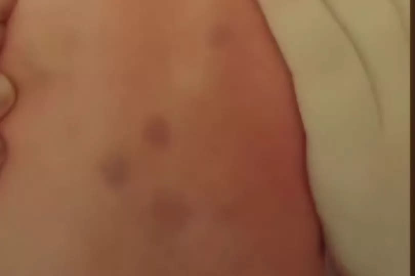 Amelia's purple spots