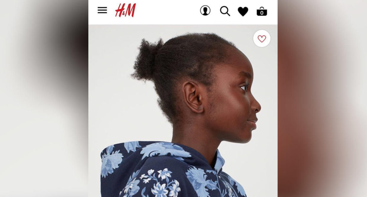 H&M is under fire for photographing a young black model with "messy" natural hair. (Photo: H&M)