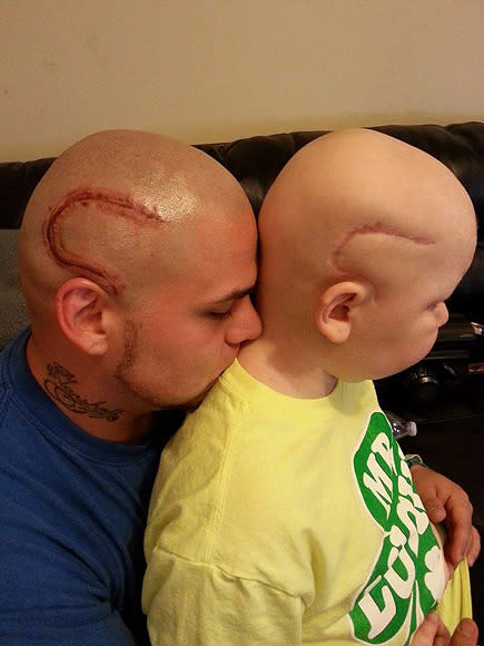 Dad Gets Scar Tattoo to Match His Son's Brain Cancer Surgery Scar: 'I Wanted to Take Away Some of the Stares'| Cancer, Health, Bodywatch