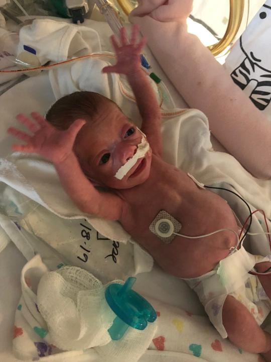 Baby Andi Williams, born three months premature, stretches out in the NICU at nearly 6 weeks old