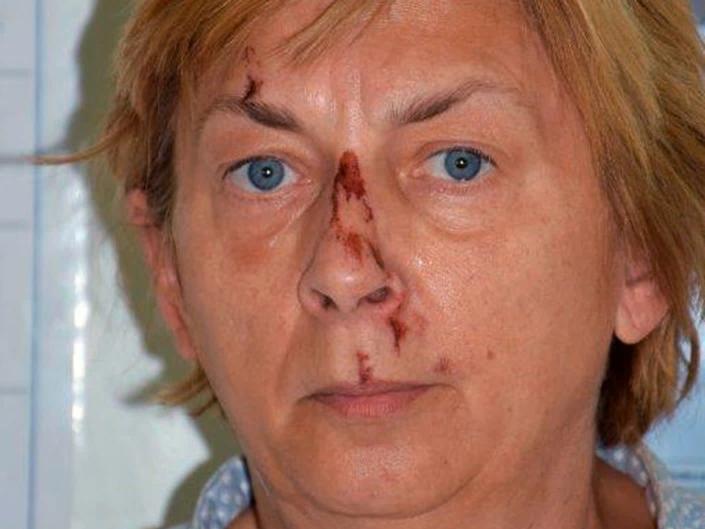 A woman was found with no memory and  cuts and bruises on her face on the Croatian island of Krk (Croatian Police/AP)