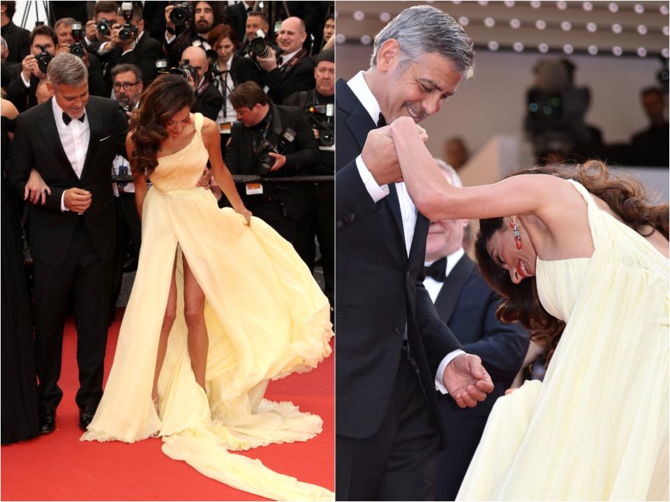 Side by side of Amal looking down and holding open an excess of tulle on her yellow gown and exposing her legs up to her crotch. George holds her hand and she hunches over, stumbling up steps in her gown.