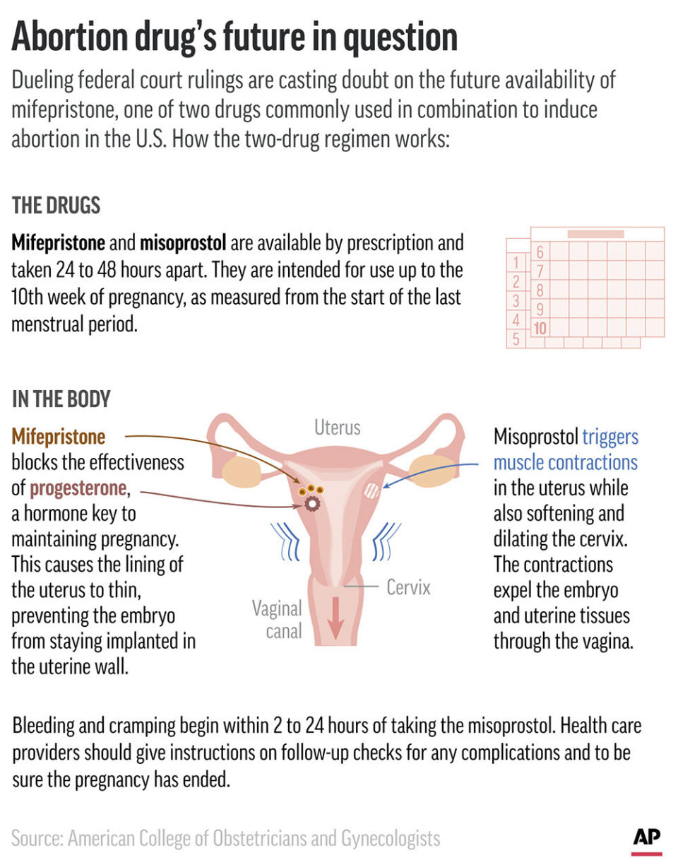 Two federal courts have issued contradictory rulings about whether a drug used as part of a medication abortion regimen should remain available. (AP Graphic)