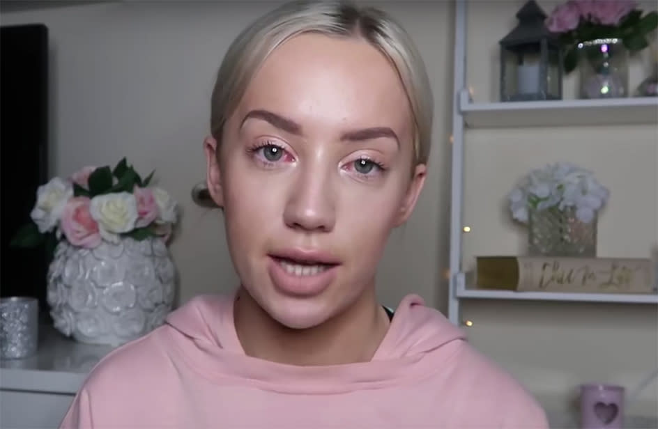 Elle Darby, l’influencer 22enne inglese che ha cercato di ottenere un soggiorno gratuito in un hotel di Dublino (YouTube)